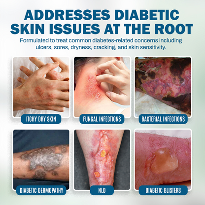 NEGUSY™ Wound & Ulcer Healing Solution